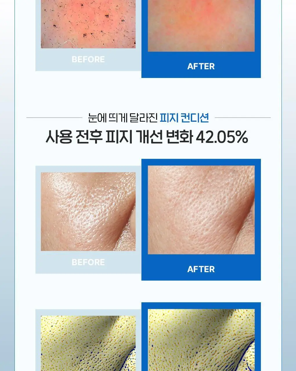 [이나연 PICK] 폰즈 모공 타이트닝 매듭 팩클렌저 150ml 상세페이지 19